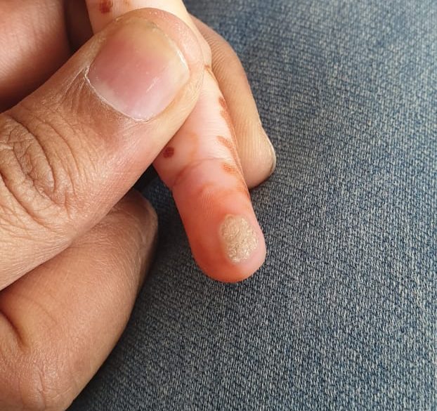 WhatsApp Image 2020-07-29 at 2.21.17 PM